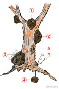 木に出来る瘤（こぶ）の説明
